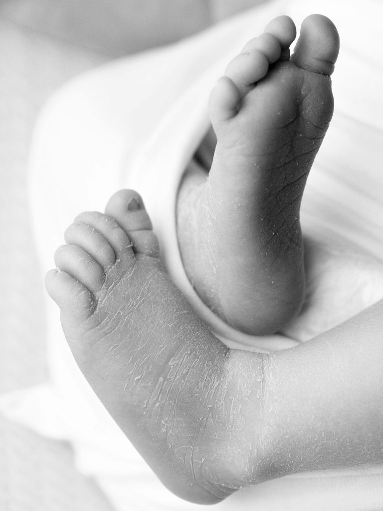Tiny-Toes-newborn-photoshoot Tiny toes with flaky skin, newborn photoshoot